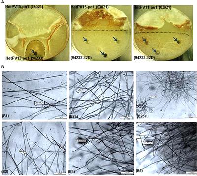 Alphapartitiviruses of Heterobasidion Wood Decay Fungi Affect Each Other's Transmission and Host Growth